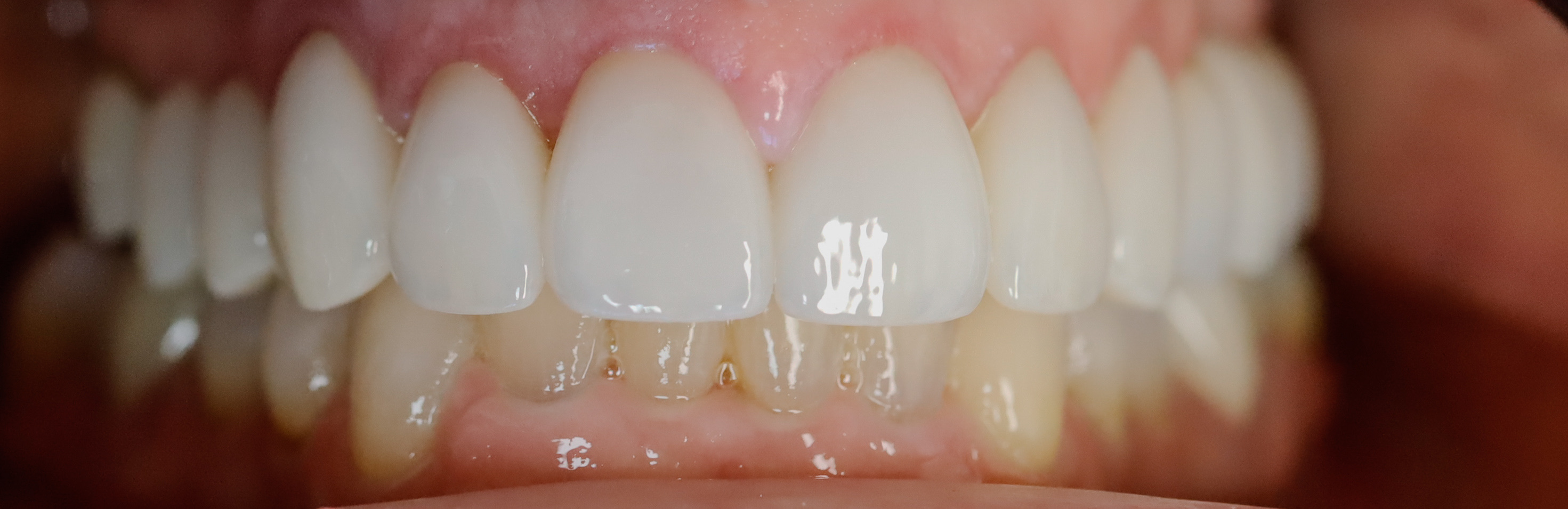 After — case 2