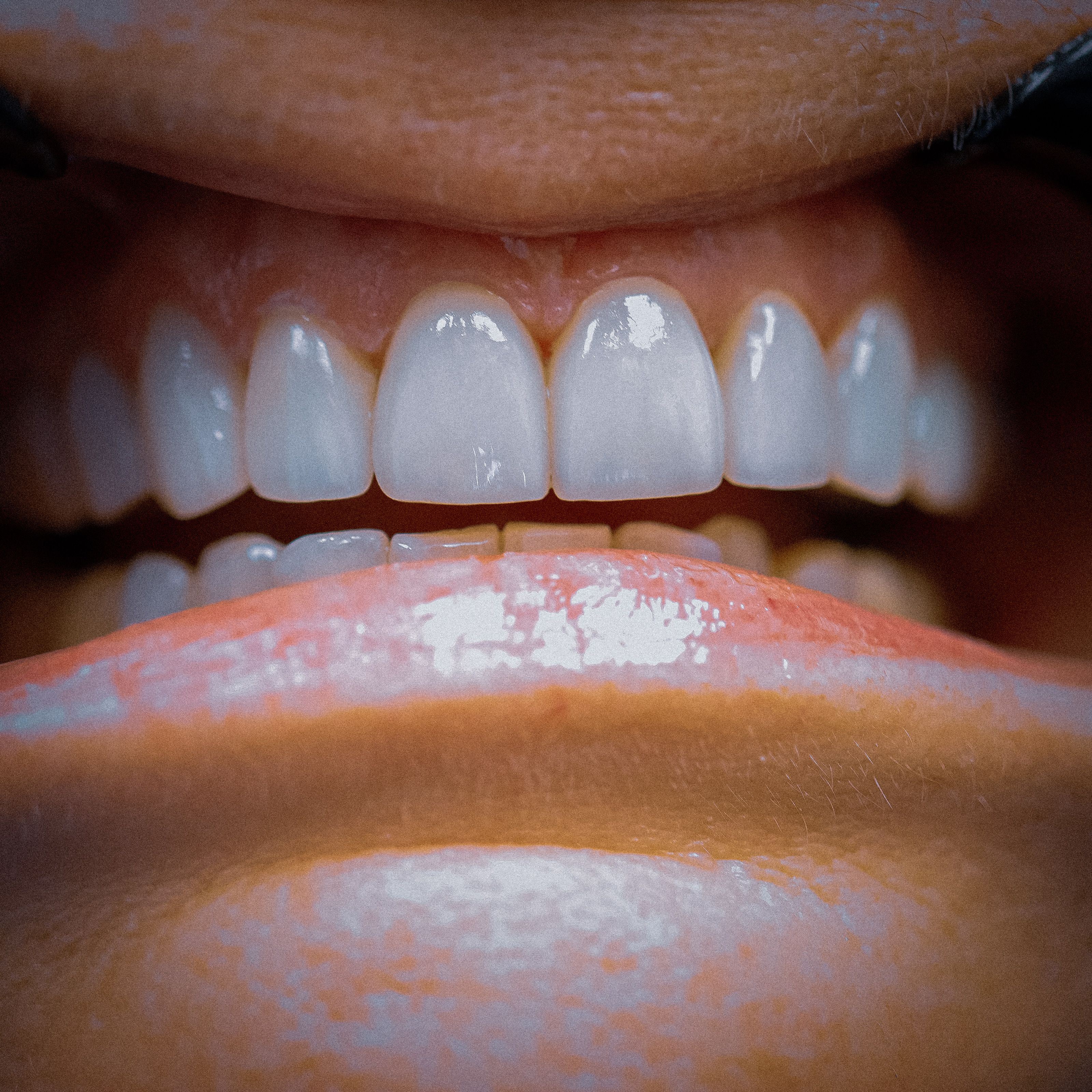 After — case 5