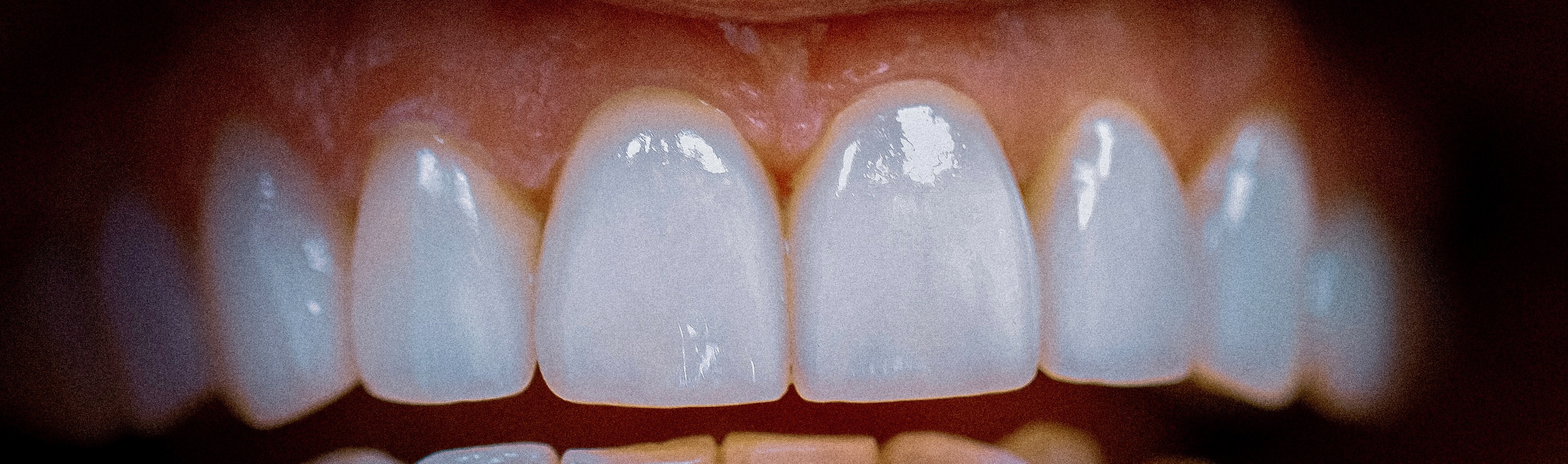 After — case 6