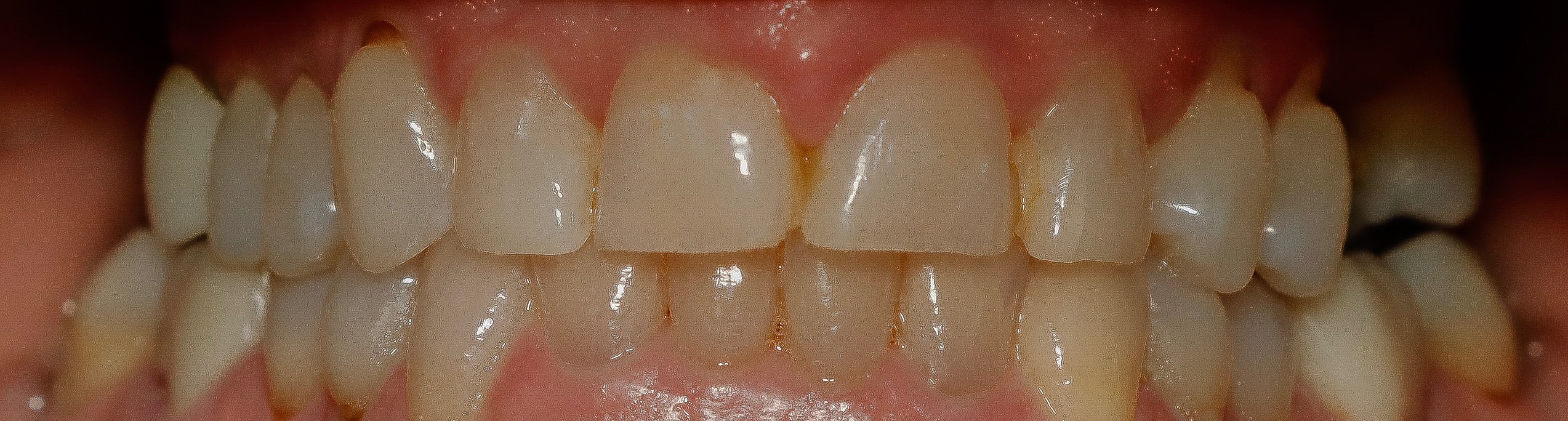 Before — case 2