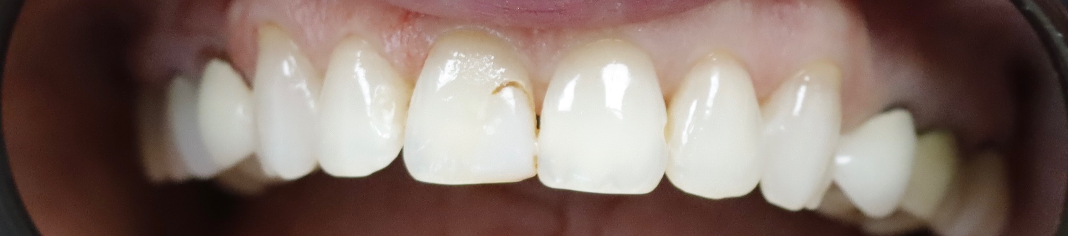 Before — case 6
